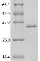 Human Calcineurin B homologous protein 1 (CHP1) Recombinant Protein, C-His, aa 2–195, E.coli - BioCrest Sci
