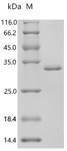 Human Calcineurin B homologous protein 1 (CHP1) Recombinant Protein, C-His, aa 2–195, E.coli, Homo sapiens (Human), E.coli, C-terminal 6xHis-tagged, 29.2 kDa, purity >≥ 95% as determined by SDS-PAGE.