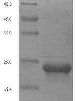 Human Type-2 angiotensin II receptor (AGTR2), partial Recombinant Protein - BioCrest Sci
