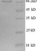 Human Golgi membrane protein 1 (GOLM1), partial Recombinant Protein, N-GST - BioCrest Sci