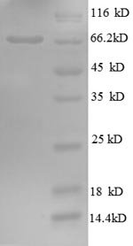 Human Golgi membrane protein 1 (GOLM1), partial Recombinant Protein, N-GST, Homo sapiens (Human), E.coli, N-terminal GST-tagged, 68.6 kDa, purity >≥ 90% as determined by SDS-PAGE.