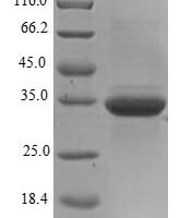 Human Ganglioside GM2 activator (GM2A) Recombinant Protein, N-His-SUMO - BioCrest Sci