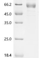 Human Leukocyte immunoglobulin-like receptor subfamily A member 4 (LILRA4), partial Recombinant Protein - BioCrest Sci