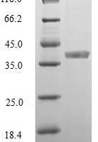 Plasmodium falciparum Merozoite surface protein 2 (MSP2), partial Recombinant Protein, N-GST - BioCrest Sci