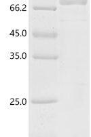 Mouse Toll-like receptor 7 (Tlr7), partial Recombinant Protein, C-hFc1 - BioCrest Sci