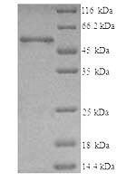 Human T-complex protein 1 subunit beta (CCT2) Recombinant Protein, N-His, aa 2–535, Yeast - BioCrest Sci