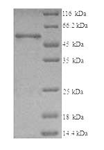 Human T-complex protein 1 subunit beta (CCT2) Recombinant Protein, N-His, aa 2–535, Yeast, Homo sapiens (Human), Yeast, N-terminal 6xHis-tagged, 59.4 kDa, purity >≥ 90% as determined by SDS-PAGE.