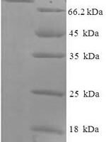 Macaca fascicularis albumin (ALB) Recombinant Protein, N-His-SUMO - BioCrest Sci
