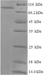 Macaca fascicularis albumin (ALB) Recombinant Protein, N-His-SUMO, Macaca fascicularis (Crab-eating macaque) (Cynomolgus monkey), E.coli, N-terminal 6xHis-SUMO-tagged, 82.0 kDa, purity >≥ 90% as determined by SDS-PAGE.