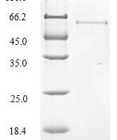 Human Collagen alpha-6 (VI) chain (COL6A6), partial Recombinant Protein - BioCrest Sci