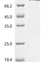 Human Aconitate hydratase, mitochondrial (ACO2)(K68R) Recombinant Protein - BioCrest Sci