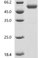 Rat Interferon beta (Ifnb1) Recombinant Protein, N-hFc1 - BioCrest Sci