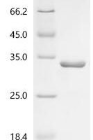 Escherichia coli O157:H7 Transcriptional regulatory protein qseB (qseB) Recombinant Protein - BioCrest Sci