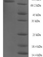 Human NXPE family member 3 (NXPE3) Recombinant Protein - BioCrest Sci