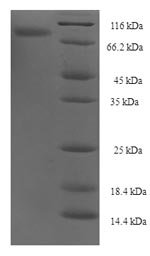 Human NXPE family member 3 (NXPE3) Recombinant Protein, Homo sapiens (Human), E.coli, N-terminal 6xHis-SUMO-tagged, 76.3 kDa, purity >≥ 90% as determined by SDS-PAGE.