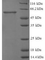 Human N-acetyl-D-glucosamine kinase (NAGK) Recombinant Protein - BioCrest Sci