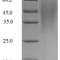 Influenza B virus Non-structural protein 1 (NS) Recombinant Protein, N-His, aa 1–281, strain B/Lee/1940, Yeast - BioCrest Sci