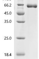 Human CGA & FSHB (linked heterodimer) Protein Recombinant Protein - BioCrest Sci