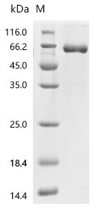 Human CGA & FSHB (linked heterodimer) Protein Recombinant Protein, Homo sapiens (Human), Mammalian cell, C-terminal hFc1-tagged, 50.5 kDa, purity >≥ 90% as determined by SDS-PAGE.