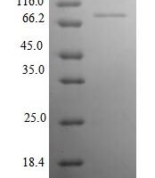 Rat Neural cell adhesion molecule 1 (Ncam1), partial Recombinant Protein - BioCrest Sci