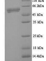 Human respiRatory syncytial virus A Fusion glycoprotein F0 (F), partial Recombinant Protein - BioCrest Sci