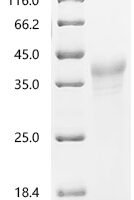 Rat Hypoxia-inducible factor 1-alpha（Hif1a), partial Recombinant Protein, N-10His - BioCrest Sci