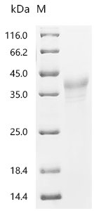 Rat Hypoxia-inducible factor 1-alpha(Hif1a), partial Recombinant Protein, N-10His, Rattus norvegicus (Rat), Mammalian cell, N-terminal 10xHis-tagged, 28.0 kDa, purity >≥ 90% as determined by SDS-PAGE.≥ 95% as determined by SEC-HPLC.