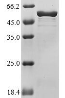 Yersinia pestis Virulence-associated V antigen (lcrV) Recombinant Protein - BioCrest Sci