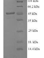 Mouse Stromelysin-1 (Mmp3) Recombinant Protein - BioCrest Sci