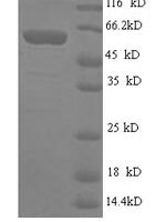 Human GPI-linked NAD(P)(+)--arginine ADP-ribosyltransferase 1(ART1) Recombinant Protein - BioCrest Sci