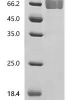 Macaca fascicularis Low affinity immunoglobulin gamma Fc region receptor III-A (FCER1A), partial Recombinant Protein - BioCrest Sci