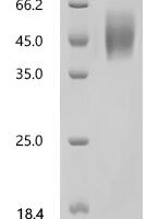 Human Fibroblast growth factor receptor 2(FGFR2), partial Recombinant Protein - BioCrest Sci
