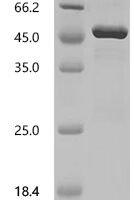 Human RISC-loading complex subunit TARBP2 (TARBP2) Recombinant Protein, N-His - BioCrest Sci