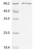 Human RAC-alpha serine/threonine-protein kinase (AKT1) Recombinant Protein - BioCrest Sci