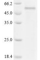 Human Caspase-3(CASP3) Recombinant Protein - BioCrest Sci
