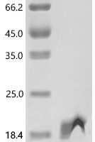 Human Cyclin-dependent kinases regulatory subunit 2 (CKS2) Recombinant Protein - BioCrest Sci