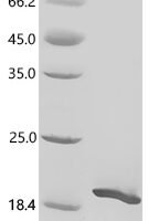 Mouse Acyl-CoA desaturase 1 (Scd1), partial Recombinant Protein - BioCrest Sci