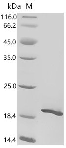 Mouse Acyl-CoA desaturase 1 (Scd1), partial Recombinant Protein, Mus musculus (Mouse), E.coli, C-terminal 6xHis-tagged, 17.8 kDa, purity >≥ 90% as determined by SDS-PAGE.