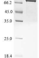 Human Poly [ADP-ribose] polymerase 2 (PARP2) Recombinant Protein, N-His, aa 1–583, E.coli - BioCrest Sci