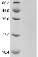 Mouse Probable cytosolic iron-sulfur protein assembly protein CIAO1 (Ciao1) Recombinant Protein, C-10His-HSA - BioCrest Sci