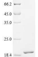 Chicken AMP deaminase 1 (AMPD1) Recombinant Protein - BioCrest Sci
