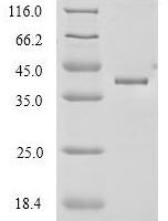Mouse Anthrax toxin receptor 1 (Antxr1), partial Recombinant Protein - BioCrest Sci