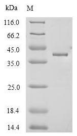 Mouse Anthrax toxin receptor 1 (Antxr1), partial Recombinant Protein, Mus musculus (Mouse), Mammalian cell, N-terminal 6xHis-Myc-tagged, 36.3 kDa, purity >≥ 90% as determined by SDS-PAGE.