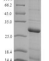 Rat Thyroxine 5-deiodinase (Dio3), partial (170:U→missing) Recombinant Protein, N-His, aa 63–304 (170:U→missing), E.coli - BioCrest Sci