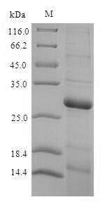 Rat Thyroxine 5-deiodinase (Dio3), partial (170:U→missing) Recombinant Protein, N-His, aa 63–304 (170:U→missing), E.coli, Rattus norvegicus (Rat), E.coli, N-terminal 6xHis-tagged, 31.5 kDa, purity >≥ 90% as determined by SDS-PAGE.