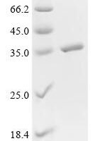 Enterobacteria phage lambda Recombination protein bet (bet) Recombinant Protein - BioCrest Sci
