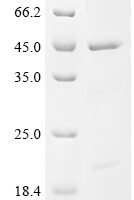 Human Eukaryotic initiation factor 4A-I (EIF4A1) Recombinant Protein, Tag-Free - BioCrest Sci