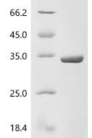 Human Deoxyribonuclease-1 (DNASE1) Recombinant Protein, N-10His/C-Myc - BioCrest Sci