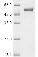 Shigella flexneri Putative multidrug resistance outer membrane protein MdtQ (mdtQ) Recombinant Protein - BioCrest Sci