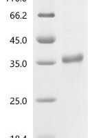 Human Cathepsin G (CTSG) Recombinant Protein, C-His, aa 21–255, Baculovirus - BioCrest Sci